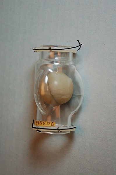 The Hufnagel Heart Valve developed in the 1950s. Credit: National Museum of Health and Medicine / Wikipedia